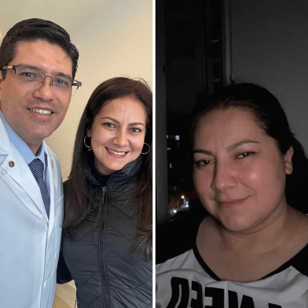 Antes y despues cirugía bariátrica
