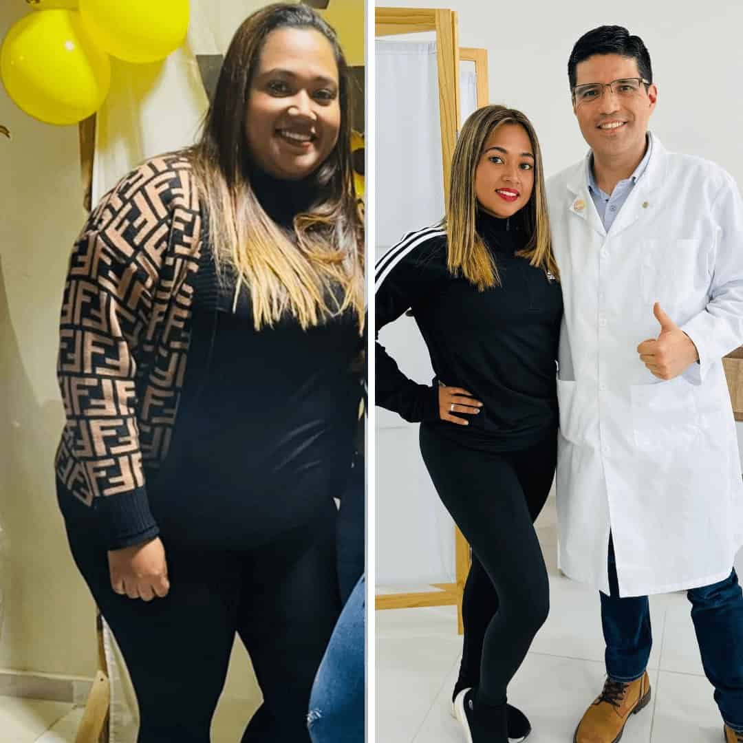 Caso de éxito cirugía bariátrica