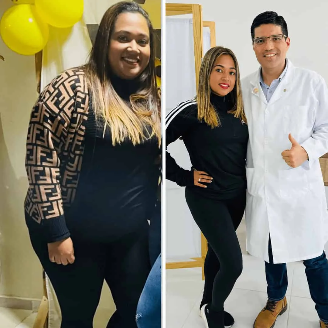 Caso de éxito cirugía bariátrica
